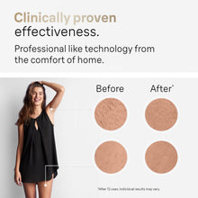 Load image into Gallery viewer, Braun IPL at Home Laser Hair Removal for Women and Men, Silk Expert Pro 5 PL5137 with Venus Swirl Razor, Long-Lasting Reduction in Hair Regrowth for Body & Face, Corded, PL5137