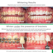 Load image into Gallery viewer, Opalescence Go 15- Prefilled Teeth Whitening Trays Kit - 15% Hydrogen Peroxide - (10 Treatments) Dentist Recomended - Made by Ultradent Products. Teeth Whitening Kit -Mint - 5194-1