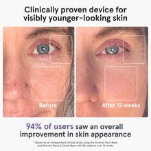 Load image into Gallery viewer, iRestore LED Face Mask for Youthful Skin, Red Light Therapy for Face, Red, Blue & Infrared Therapy for Wrinkles, Fine Lines, Dark Spots with 360 LEDs, Skincare Device for Women & Men