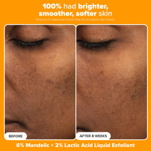Load image into Gallery viewer, Paula's Choice Brighter Days Ahead Kit, Vitamin C and AHA Trio, Includes Travel Size C5 SPF Face Sunscreen, Mandelic Acid Exfoliant, C15 Vitamin C Booster Serum, Brightening & Resurfacing, 3-Piece Set