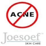 Load image into Gallery viewer, Sulfur Soap for Acne Pharmaceutical Grade Dermatologists FDA Approved for Acne Rosacea 100G