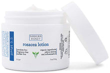 Load image into Gallery viewer, Rosacea Red Skin and Acne Cream - with Manuka Honey, Aloe Vera & Coconut Oil - Redness, Inflammation, Acne and Rosacea Relief - Paraben & Sulfate Free (2 oz)