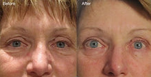 Load image into Gallery viewer, ANTI-AGING- MAGIC DMAE+MSM+NIACIN Firming Cream, 100% Pure Hyaluronic Acid, Argireline, Matrixyl 3000