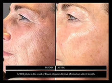 Load image into Gallery viewer, Vitamin C Serum & Retinol Cream for Face Bundle - Natural & Organic Anti Aging Skin Care Set for Men & Women to Reduce Wrinkles and Dark Spots