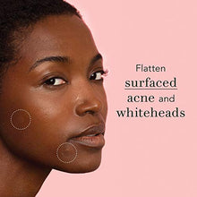 Load image into Gallery viewer, Rael Acne Pimple Healing Patch - Absorbing Cover, Invisible, Blemish Spot, Hydrocolloid, Skin Treatment, Facial Stickers, Two Sizes 10mm & 12mm, Blends in with skin (96 Count)