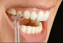 Load image into Gallery viewer, Waterpik Wp100 Ultra Water Flosser