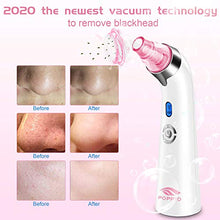 Load image into Gallery viewer, Blackhead Remover Pore Vacuum - Electric Blackhead Vacuum Cleaner Blackhead Extractor Tool Device Comedo Removal Suction Beauty Device for Women(Pink)