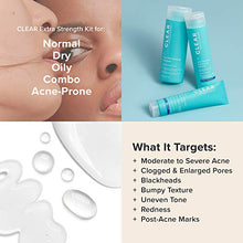 Load image into Gallery viewer, Paula's Choice CLEAR Extra Strength Acne Kit, 2% Salicylic Acid & 5% Benzoyl Peroxide for Severe Acne, Redness Relief, PACKAGING MAY VARY