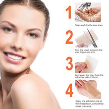 Load image into Gallery viewer, Silicone Scar Sheet, Scar Away, Scar Removal Treatment Sheet, 5.9'' x 1.6'',5 Pack, for Hypertrophic Scar,Keloid Scar,C-section Scar,Surgery Scar,Burn Scar, Acne Scar Removal Treatment by Ealionmed