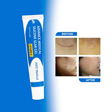 Load image into Gallery viewer, Silicone Gel for Scar Removal with Vitamin E Oil – With Anti Scarring Ingredients Vitamin E and Silicone – Treatment for Acne Scar, Surgical Scar Treatment 30gm
