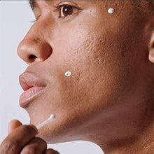 Load image into Gallery viewer, Malin + Goetz Acne Treatment Nighttime overnight spot-treatment, treats blemishes without drying skin. calms skin, fights impurities, prevents signs of scarring. all skin types, vegan. 0.5 fl.oz.