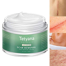 Load image into Gallery viewer, Scar Removal Cream Advanced Treatment for Old & New Scars from Cuts Stretch Marks, C-Sections & Surgeries With Natural Herbal Extracts Formula
