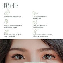 Load image into Gallery viewer, TreeActiv Acne Scar Cream 2 fl oz (60 ml), Advanced Anti Blemish Treatment for Face and Body, Topical Facial Corrector for Post Acne Marks and Dark Spots, Banish Old and New Scars