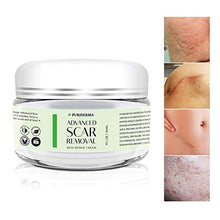 Load image into Gallery viewer, Scar Removal Cream - Advanced Treatment for Face & Body, Old & New Scars from Cuts, Stretch Marks, C-Sections & Surgeries - With Natural Herbal Extracts Formula