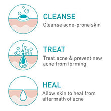Load image into Gallery viewer, CeraVe Acne Foaming Cream Cleanser | Acne Treatment Face Wash with 4% Benzoyl Peroxide, Hyaluronic Acid, and Niacinamide | Cream to Foam Formula | 5 Oz
