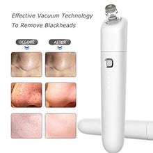 Load image into Gallery viewer, Blackhead Remover Pore Extractor Vacuum Cleaner, Professional Home Spa Skin Care Pimple Acne Whitehead Sucker Cleanser Kit with 4 Probes For Women Men Face Tool Blackhead Vacume Remover