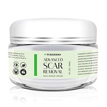 Load image into Gallery viewer, Scar Removal Cream - Advanced Treatment for Face & Body, Old & New Scars from Cuts, Stretch Marks, C-Sections & Surgeries - With Natural Herbal Extracts Formula