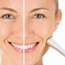 Load image into Gallery viewer, Beurer Professional at-Home Microdermabrasion, Revitalizes, Exfoliates and Rejuvenates Skin - Advanced Facial Treatment w/Vacuum, Anti-Aging, Blackhead Remover, Skin Lifting & Tightening.