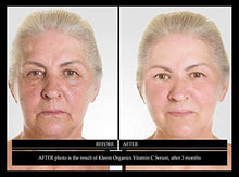 Load image into Gallery viewer, Vitamin C Serum & Retinol Cream for Face Bundle - Natural & Organic Anti Aging Skin Care Set for Men & Women to Reduce Wrinkles and Dark Spots