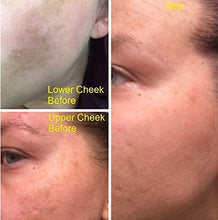 Load image into Gallery viewer, Potent Dark Spot Corrector Remover For Face & Retinol Cream Provides the Most Effective Combination For Fading & Removing Dark Spots