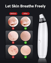Load image into Gallery viewer, BEBIRDPRO Ear Wax Removal Tool with HD Camera and 6 LED Lights, Ear Wax Removal Tool Camera with IP67,Ear Camera and Wax Remover, for iOS, Android Phones, with Blackhead Vacuum R3 PRO Black
