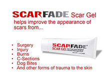 Load image into Gallery viewer, Scarfade silicone scar gel for scar removal, scar therapy - 30g Tube
