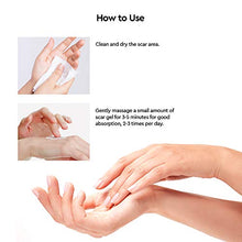 Load image into Gallery viewer, LUXROS Advanced Surgical Scar Remover Gel for Old and New Scars - Medical Grade Silicone Gel to Remove Scars from Surgery, Injury, Burns, Acne - 25g - Reduces Appearance of Keloid Scars