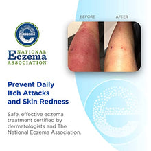Load image into Gallery viewer, Wrap-E-Soothe Ultra-Soft Non-Itch Eczema Arm or Leg Sleeves for Adults & Teens (Medium 11"-18"), Eco-Friendly Tencel Eczema Clothing, No Zinc or Dyes, USA Made