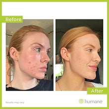Load image into Gallery viewer, Humane Maximum-Strength Acne Wash - 10% Benzoyl Peroxide Acne Treatment for Face, Skin, Butt, Back and Body - 8 Fl Oz - Dermatologist-Tested Non-Foaming Cleanser - Vegan, Cruelty-Free