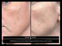 Load image into Gallery viewer, Vitamin C Serum & Retinol Cream for Face Bundle - Natural & Organic Anti Aging Skin Care Set for Men & Women to Reduce Wrinkles and Dark Spots