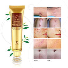Load image into Gallery viewer, Scar Removal Cream For Old Scars- Stretch Mark Removal Gel for Men & Women- Stretch Marks Relief and Burns Repair,Face Skin Repair Gel