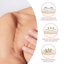 Load image into Gallery viewer, Lancs Acne Scar Removal Serum Skin Repair Essence for Reduces the Appearance of Old & New Scars, Wrinkles, Burns and Recovery Scar Treatment (5ml7 bottles)