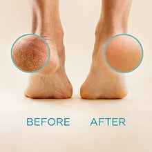 Load image into Gallery viewer, Lee Beauty Professional Callus Remover Extra Strength Gel for Feet, at Home Pedicure Results, 8 Oz