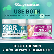 Load image into Gallery viewer, Scar Removal Cream - Effective Stretch Mark Removal - Natural Skin Repair - Acne Scar Remover Cream - Made in USA - Advanced Treatment for Old Scars & Acne Scars - Clinically Proven Formula - 2 OZ