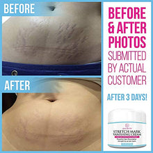 Load image into Gallery viewer, Stretch Mark Cream for Pregnancy & Scar Removal - 100% Retinol Free - Mommy Knows Best Maternity Stretch Marks Cream Removal Treatment with Cocoa and Shea Butter - Clinically Proven - 4 fl oz