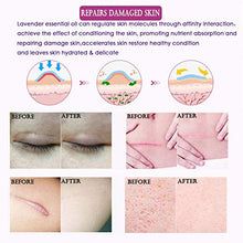 Load image into Gallery viewer, Taykoo Scar Repair Skin Essential Oil Lavender Essence Skin Care Natural Pure Remove Ance Burn Strentch Marks Scar Removal