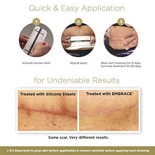 Load image into Gallery viewer, Embrace Active Scar Defense for New Scars, FDA-Cleared Silicone Scar Sheets (Size Medium (2.4 Inch)) 60 Day Supply, Pack of 2