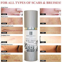 Load image into Gallery viewer, Scar & Bruise Removal Cream - Best Treatment Remedy for Healing, Skin Repair, Fading & Prevention of Old or New Acne & Stretch Mark, Surgical, Keloid, C Section, Pregnancy or Bug Bite Scars & Bruises