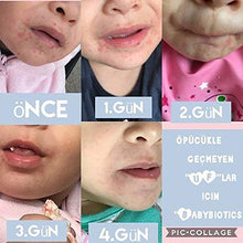 Load image into Gallery viewer, BabyBiotics - Topical Probiotic Body Care for CHILDREN of ALL AGES 4oz -Hypoallergenic, Vegan, Non GMO, GF, 100% Natural Live Probiotic Patented, External + Internal Use,Totally Safe, No Refrigeration