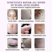 Load image into Gallery viewer, Taykoo Scar Repair Skin Essential Oil Lavender Essence Skin Care Natural Pure Remove Ance Burn Strentch Marks Scar Removal