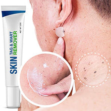 Load image into Gallery viewer, Pureskin Safe & Effective Formula Skin Tag Remover Patches Set, Skin Tag Removal Patches Set with Natural Ingredients for Your Skin Tag
