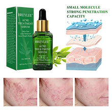 Load image into Gallery viewer, Acne Treatment Serum, BREYLEE Tea Tree Clear Skin Serum for Clearing Severe Acne, Breakout, Remover Pimple and Repair Skin (17ml,0.6oz)