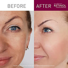 Load image into Gallery viewer, Retinol Night Cream – The Original Anti-Aging Retinol For Younger Looking Skin – Luxurious Restorative Moisturizer Works While You Sleep to Reduce Fine Lines And Other Signs of Aging