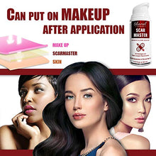 Load image into Gallery viewer, Ebanel Advanced Silicone Scar Gel, Scar Removal Cream for Old & New Scars of Acne, Surgical, C-Section, Injuries, Burn, Cuts, Insect Bites, Stretch Marks with Vitamin E, Emu Oil, Onion Extract