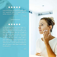 Load image into Gallery viewer, Glycolic Acid 50% Gel Peel - Enhanced with Retinol & Green Tea Extract (Professional Skin Peel)1 ounce