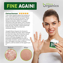 Load image into Gallery viewer, Psoriasis & Eczema Cream - Natural Eczema Treatment with Tea Tree Oil, MSM, Honey & Arnica - Made in USA - Powerful Dermatitis, Irritation & Psoriasis Treatment - Steroid-Free Psoriasis Cream - 4OZ