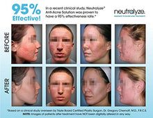Load image into Gallery viewer, Neutralyze Moderate To Severe Acne Treatment Kit 2.0 | Maximum Strength Acne Treatment System Includes Face Wash, Clearing Serum, Synergyzer + Nitrogen Boost Skincare Technology (60 Day)