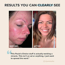 Load image into Gallery viewer, Paula's Choice CLEAR Regular Strength Acne Kit, 2% Salicylic Acid & 2.5% Benzoyl Peroxide for Facial Acne & Pores, Redness Relief, PACKAGING MAY VARY