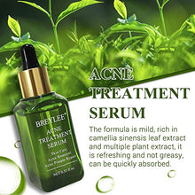 Load image into Gallery viewer, Acne Treatment Serum, BREYLEE Tea Tree Clear Skin Serum for Clearing Severe Acne, Breakout, Remover Pimple and Repair Skin (17ml,0.6oz)