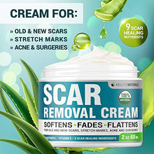 Load image into Gallery viewer, Scar Removal Cream - Effective Stretch Mark Removal - Natural Skin Repair - Acne Scar Remover Cream - Made in USA - Advanced Treatment for Old Scars & Acne Scars - Clinically Proven Formula - 2 OZ